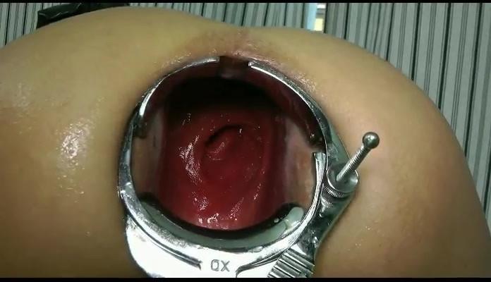 16P extreme anal fisting and speculum insertions