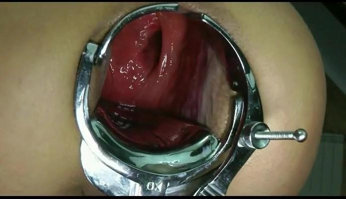 16P extreme anal fisting and speculum insertions