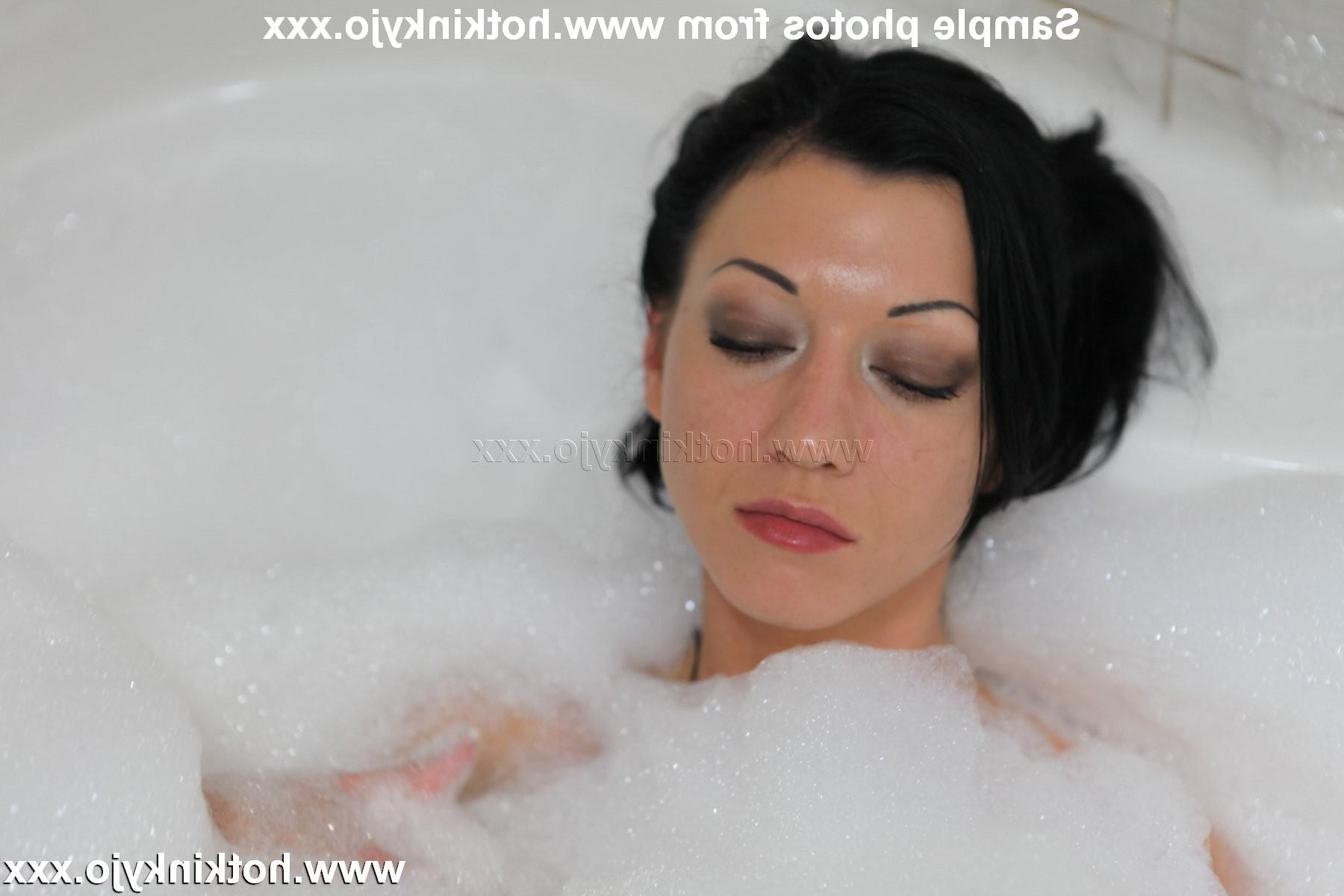 15P Extreme deep anal prolapse