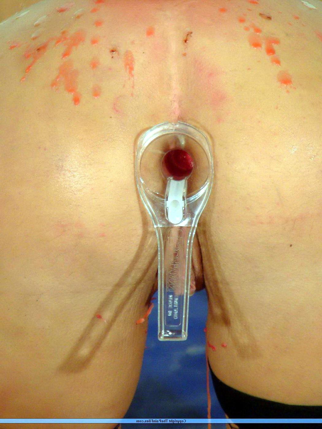 16P Burning ass bdsm and candle wax punishment of blonde English slave girl Crystel 