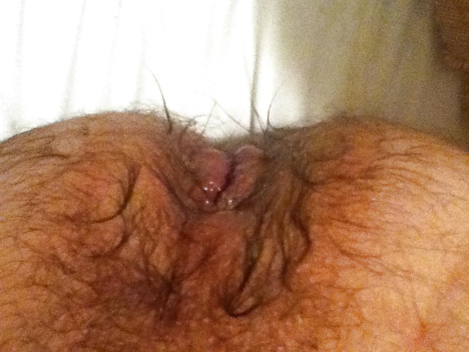 12P Anal fun
