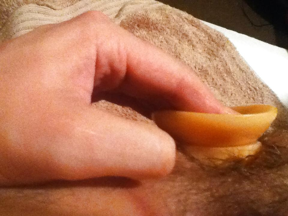 12P Anal fun