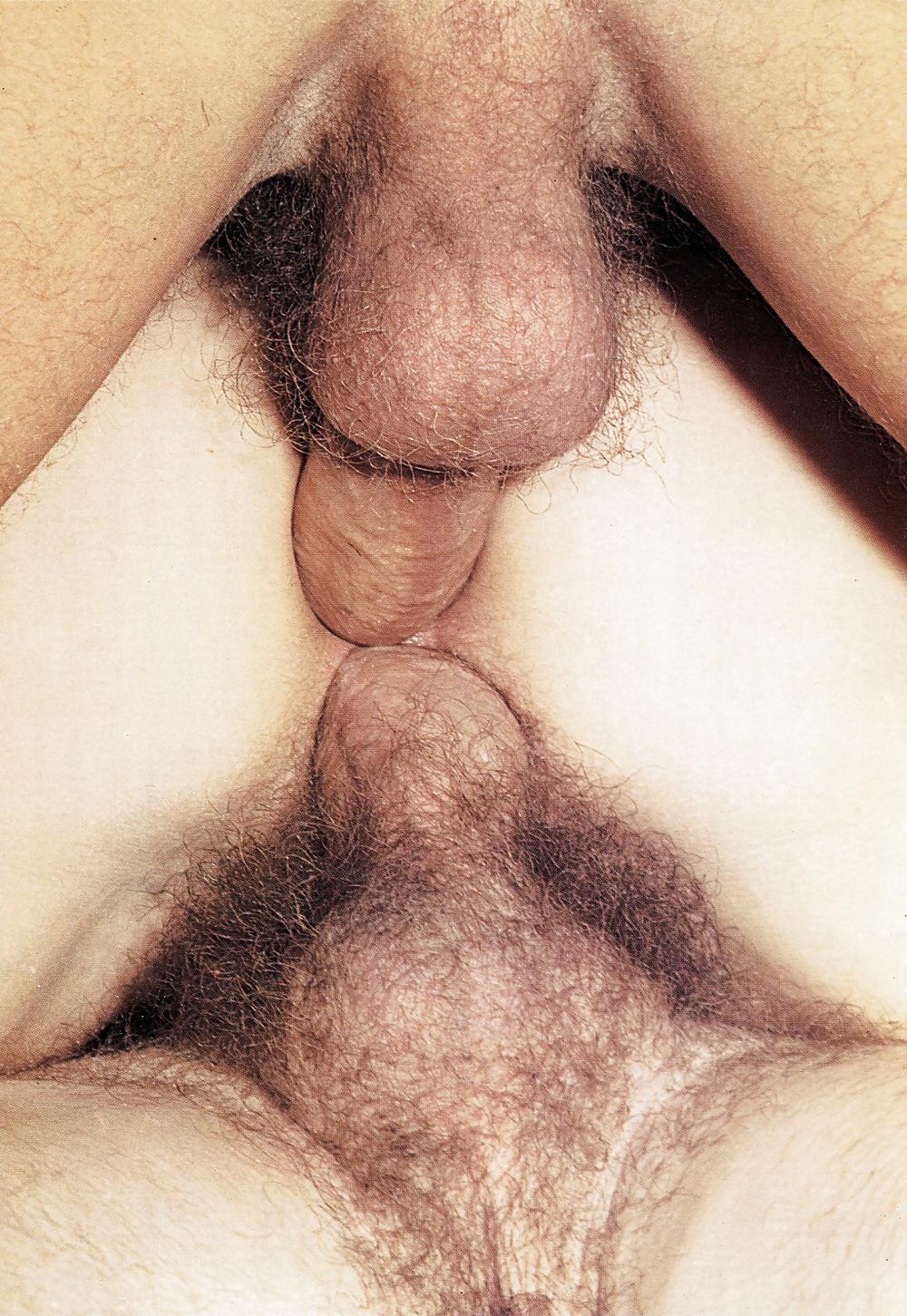 25P Classic Anal