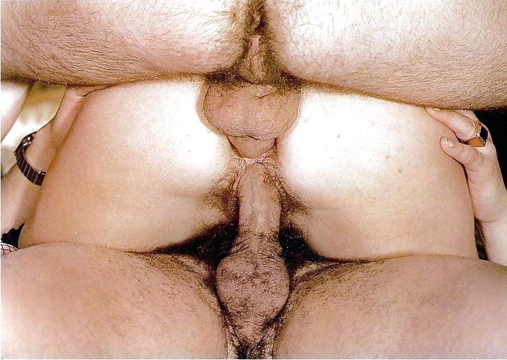 25P Classic Anal