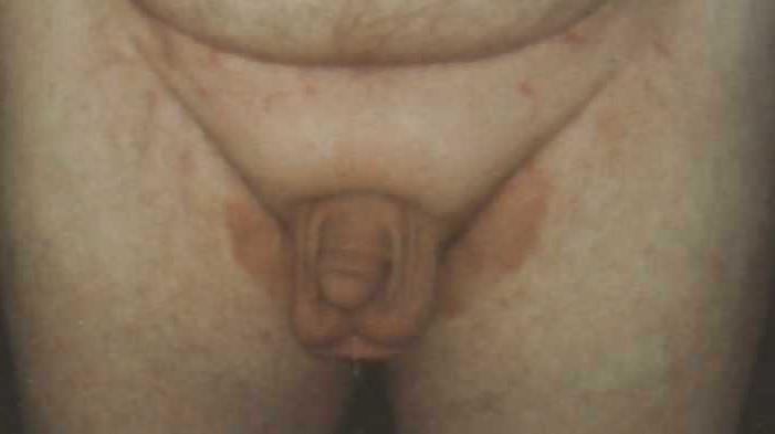 25P Mmore of mee