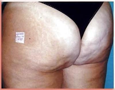 15P Big Ass Album 4