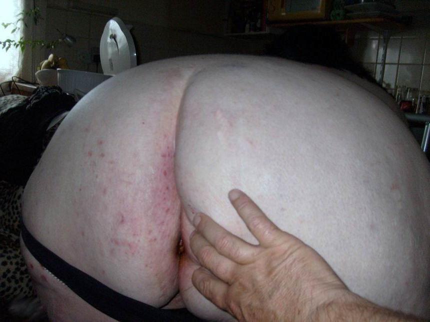 18P huge ladies showing their big cellulite bodies