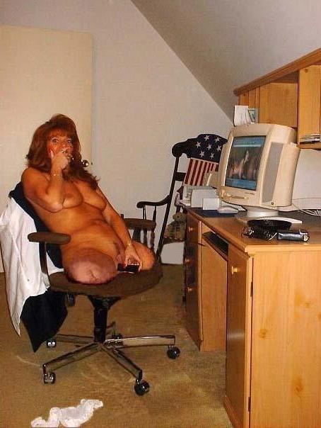 15P hot amputee women showing off their stumps
