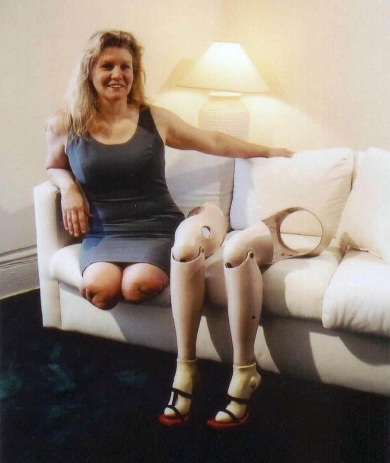 15P sexy amputee ladies posing and in action