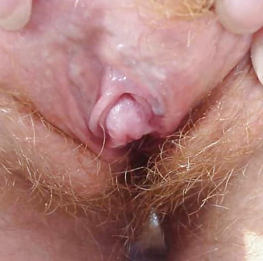 16P Big clit