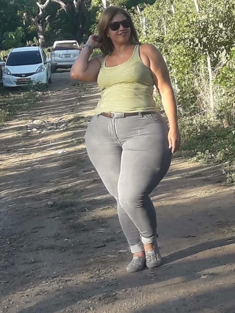 20P Wide hips (1)