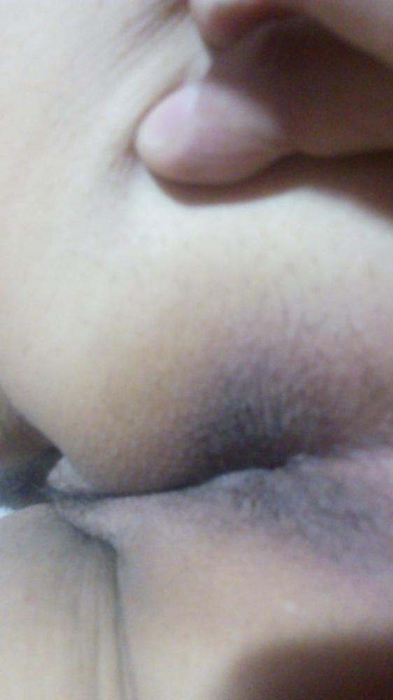 12P Anal