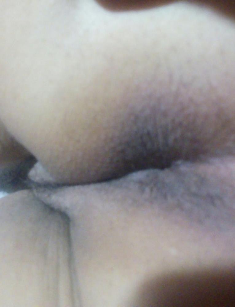 12P Anal