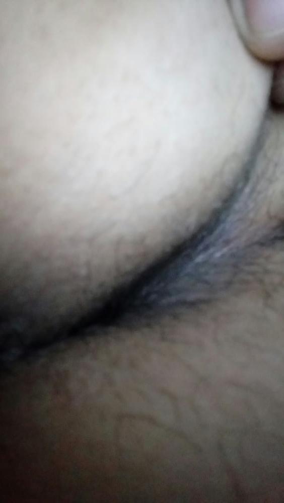 12P Anal