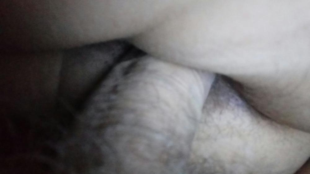 12P Anal