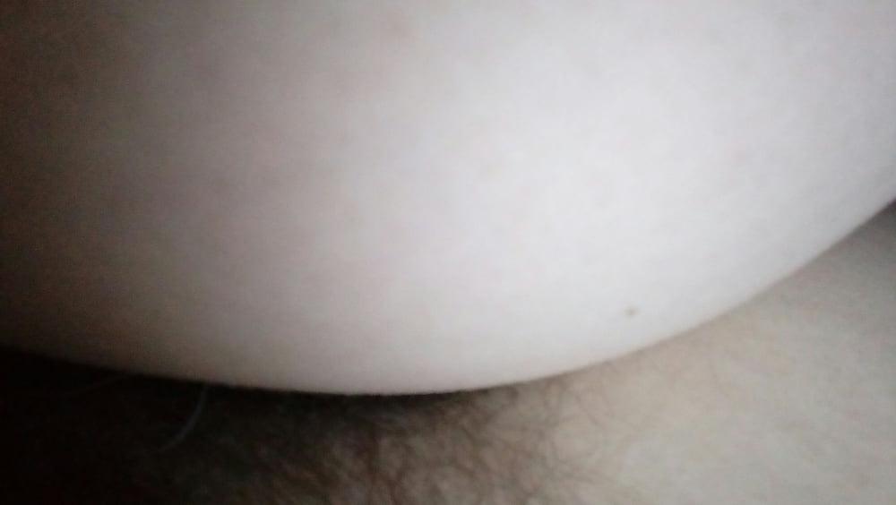 12P Anal