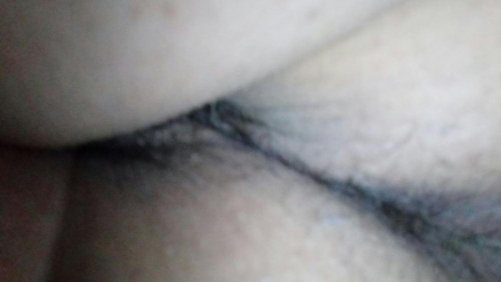 12P Anal