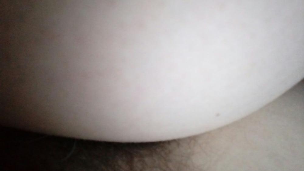 12P Anal