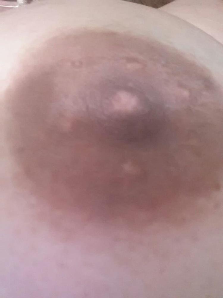 25P suegra ex
