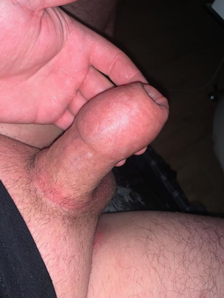 25P Erectione(3274)