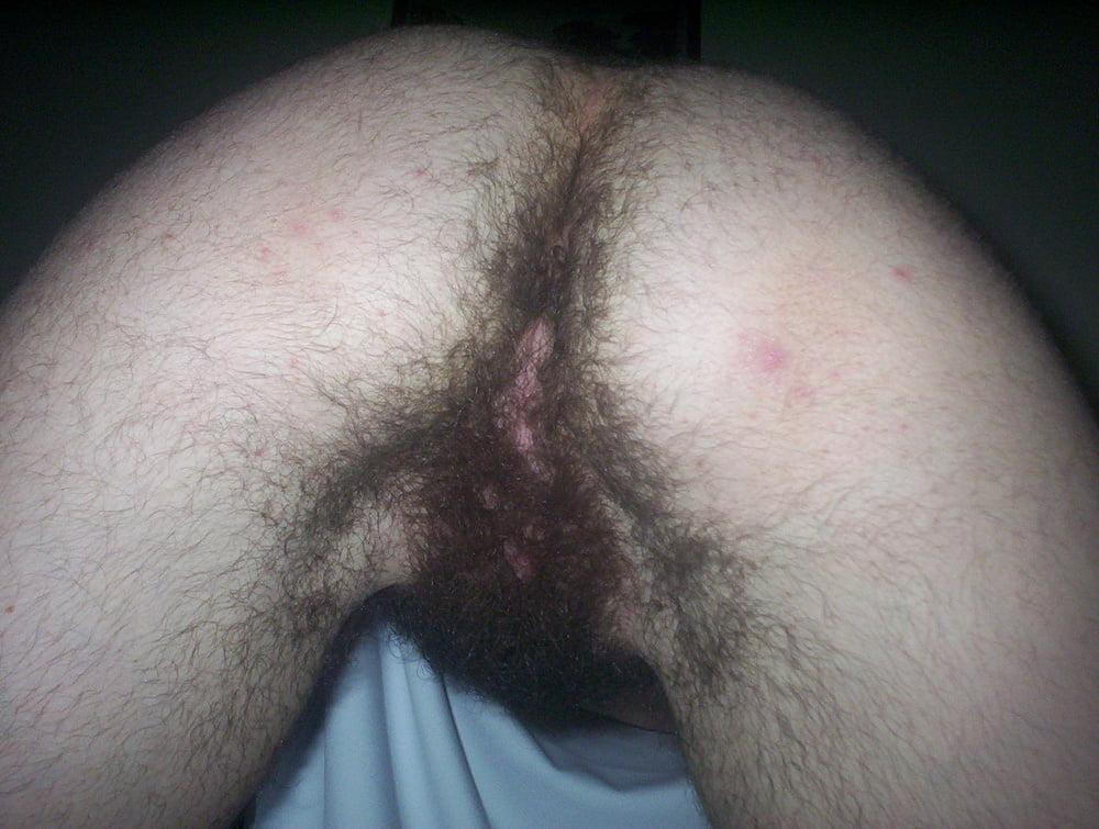 25P Homemade hairy