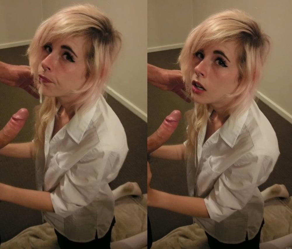 25P Gesichtsspermalappen