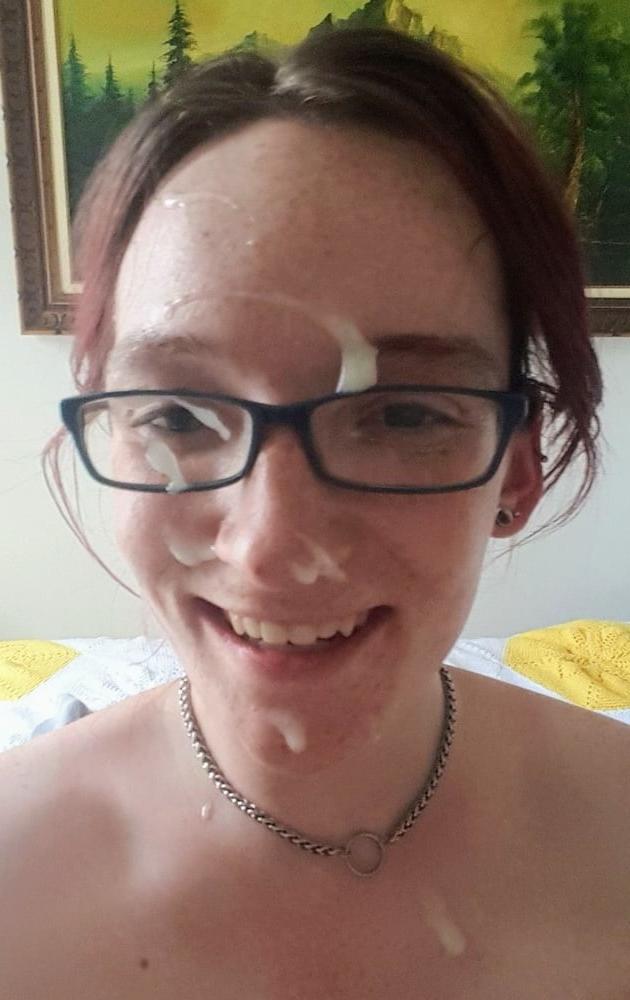 25P Gesichtsspermalappen