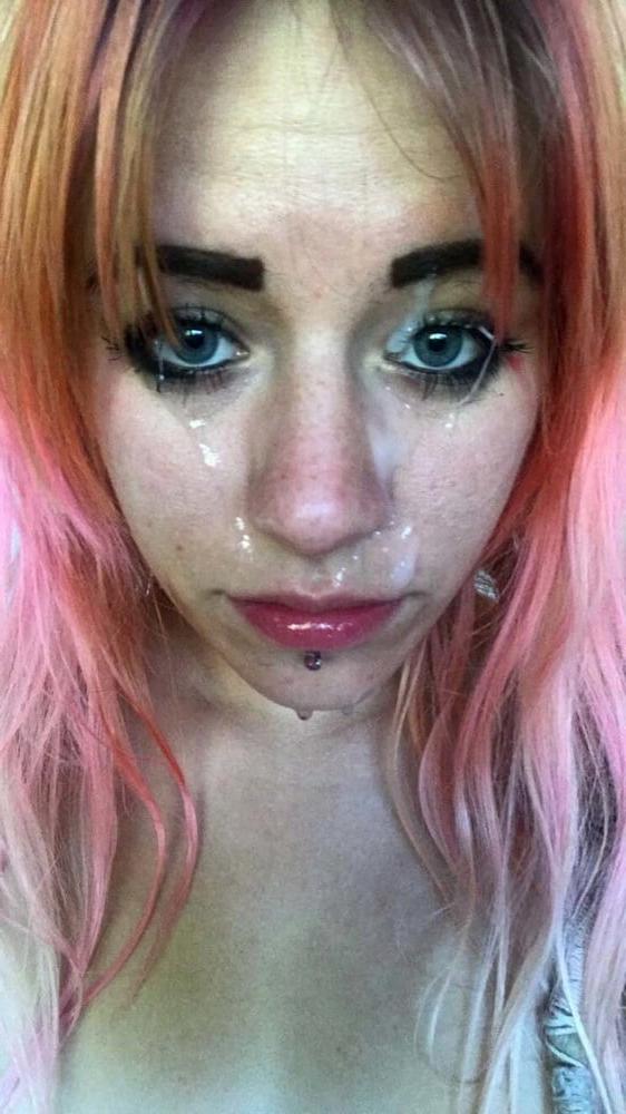 25P Gesichtsspermalappen