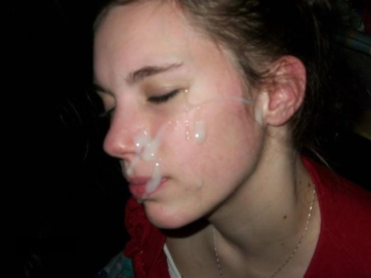 25P Gesichtsspermalappen