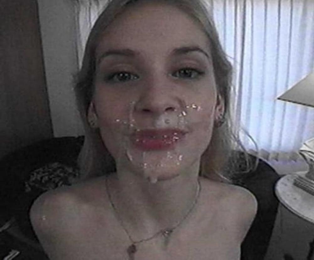 25P Gesichtsspermalappen
