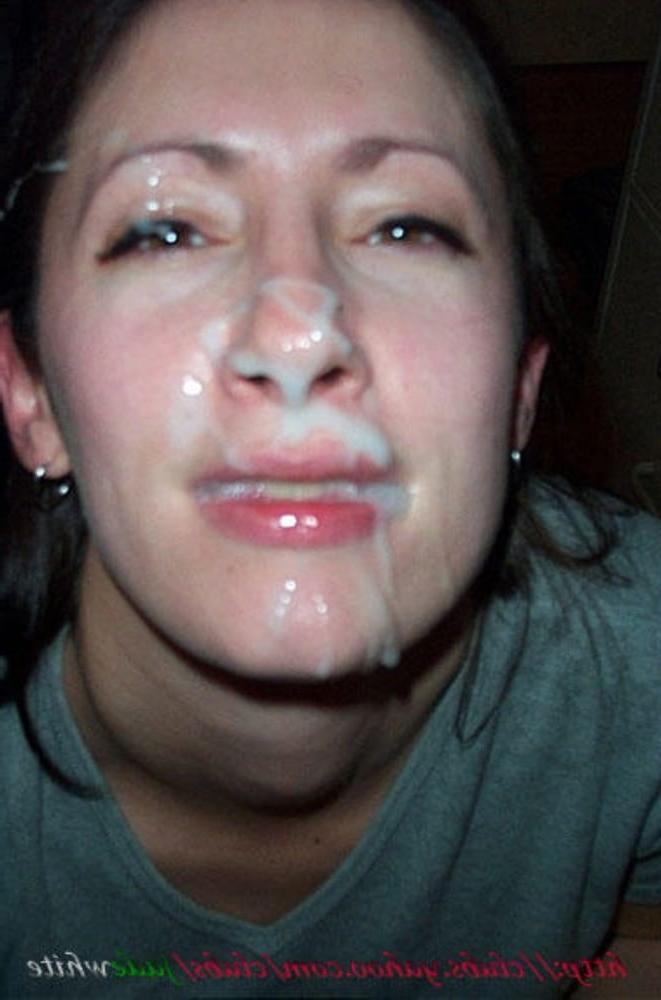 25P Gesichtsspermalappen