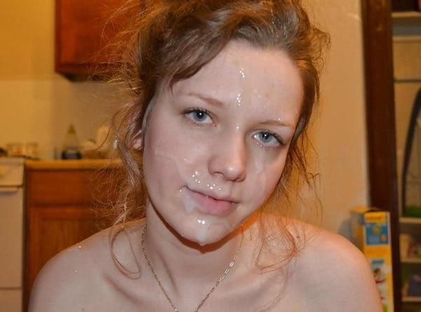 25P Gesichtsspermalappen