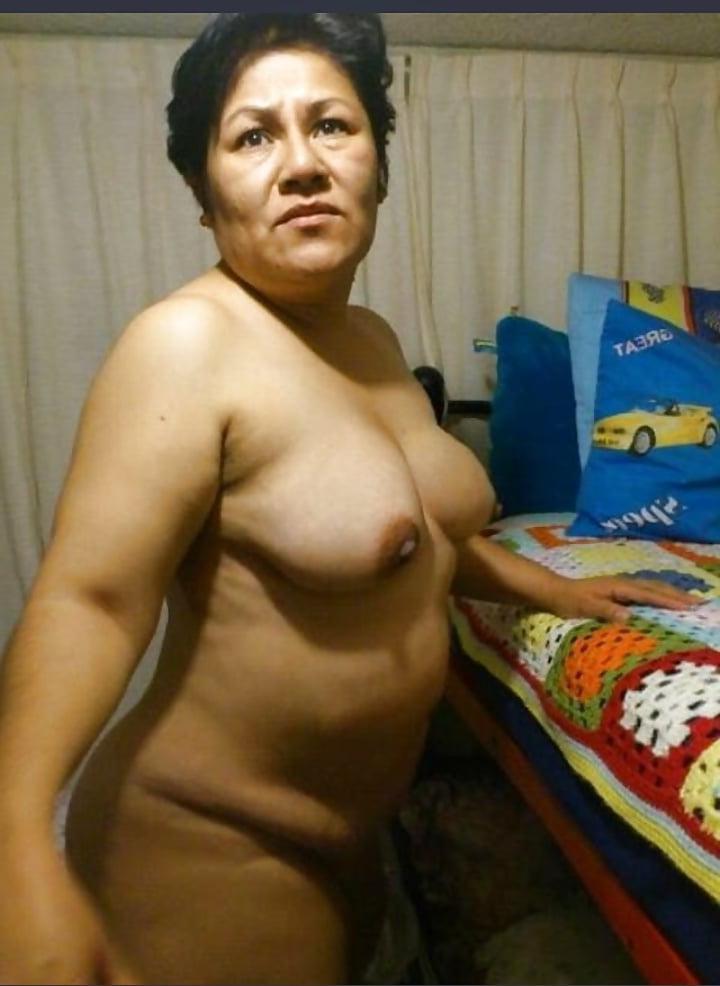 10P Gorda madura con celulitis
