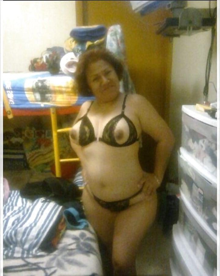 10P Gorda madura con celulitis
