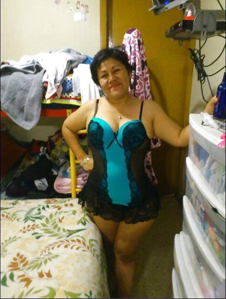 10P Gorda madura con celulitis