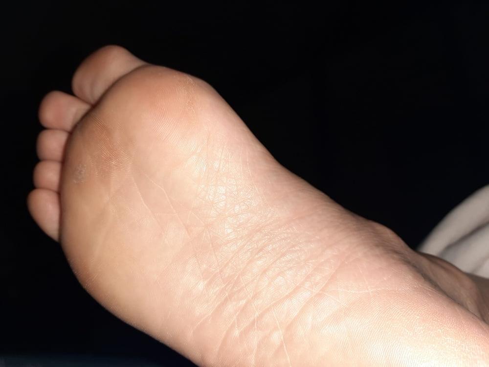 19P More Gf sole shots