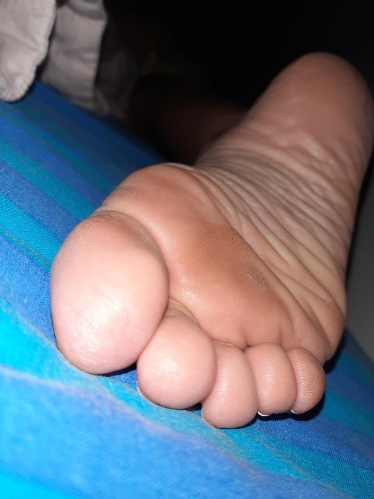 19P More Gf sole shots