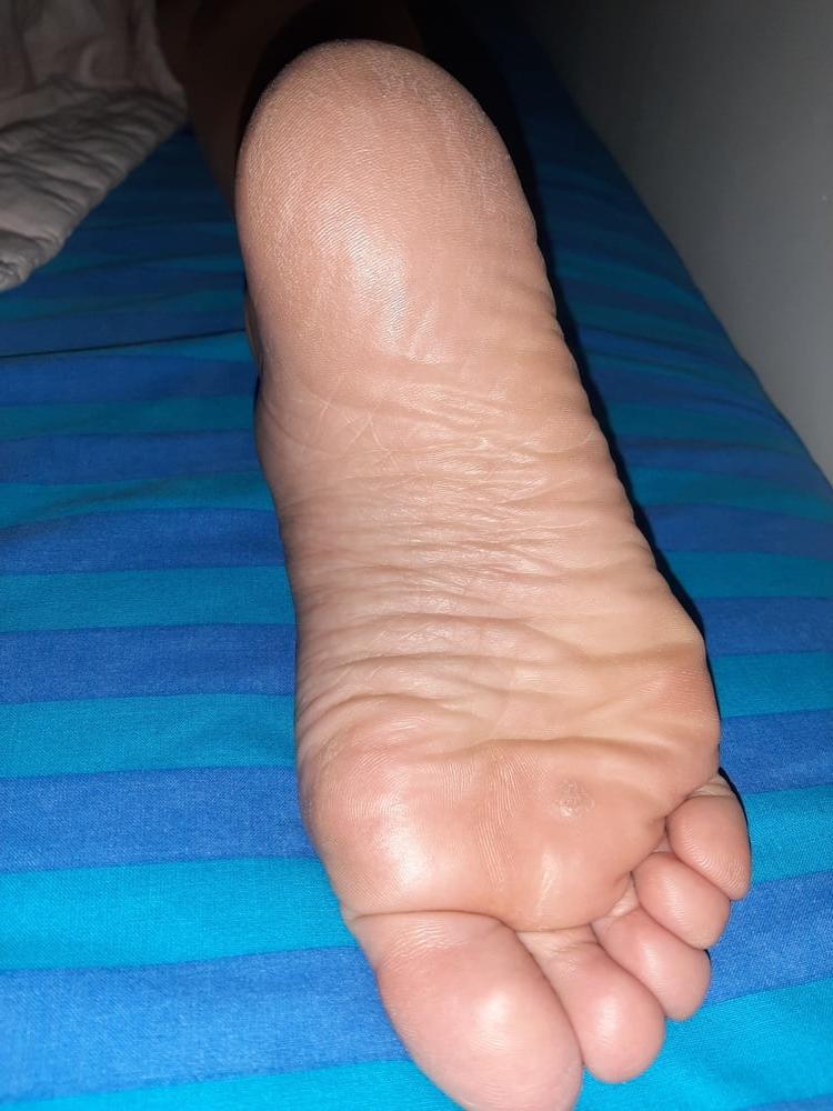 19P More Gf sole shots