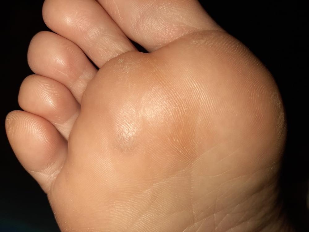 19P More Gf sole shots