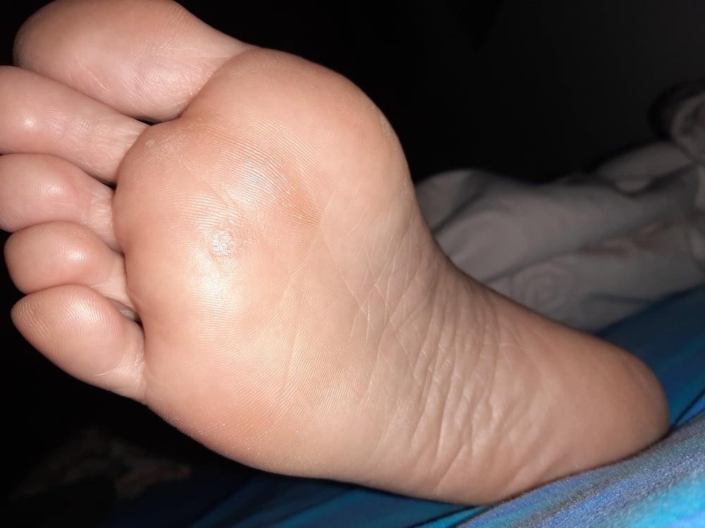 19P More Gf sole shots