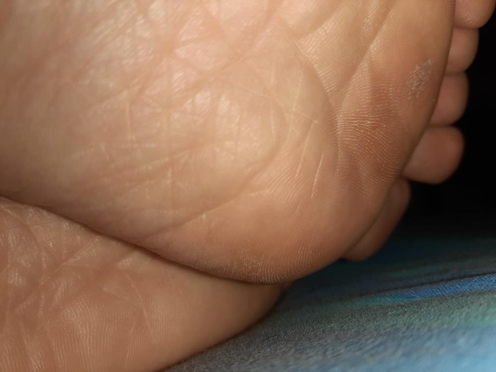 19P More Gf sole shots