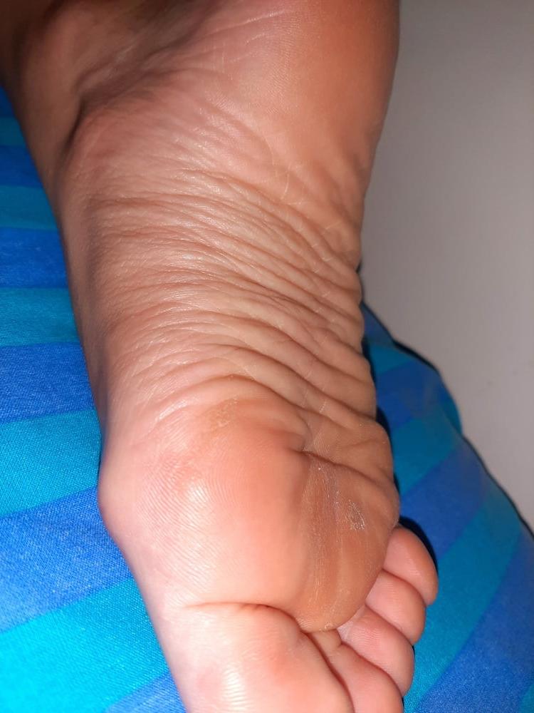 19P More Gf sole shots