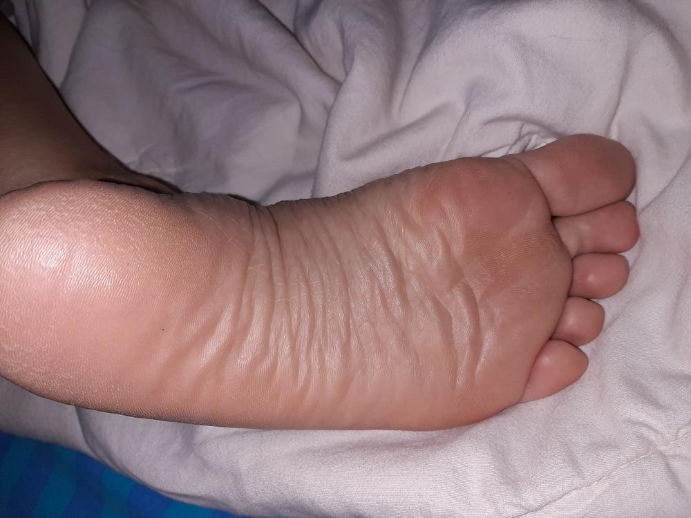 19P More Gf sole shots