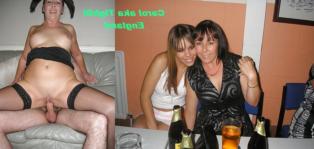 25P Erectione(3588)