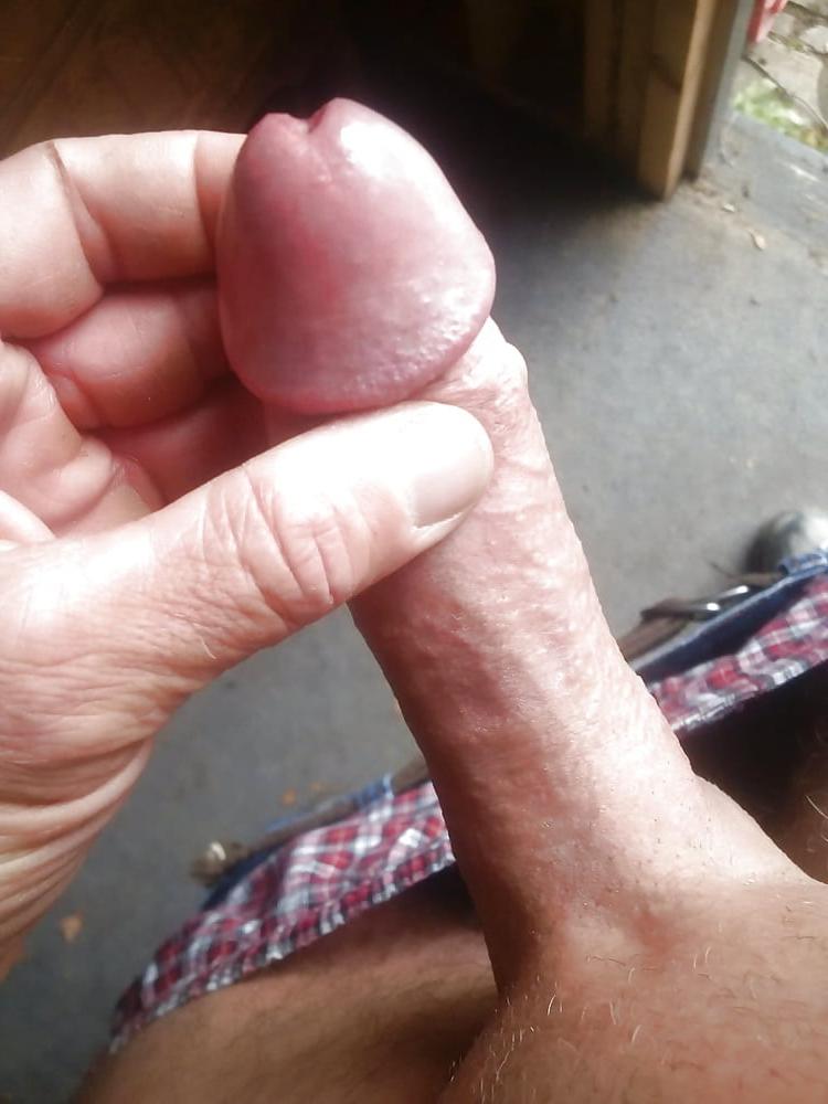 25P Erectione(3586)