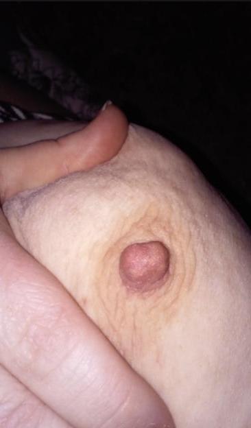 10P Humongous ssbbw 400+lbs
