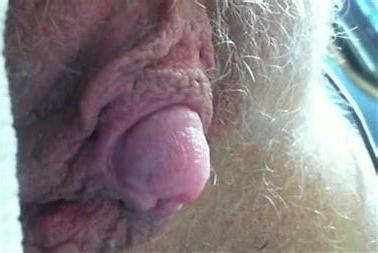 25P hot pussy n big clit's