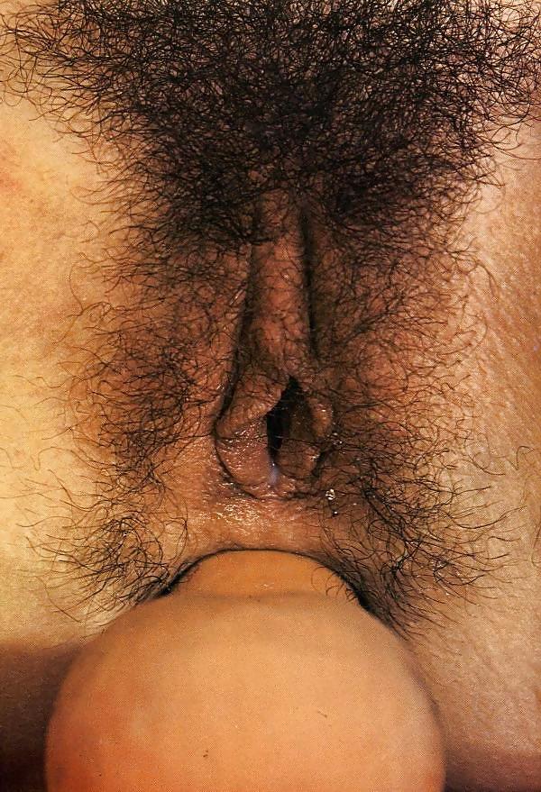 25P Retro Anal Sex Set