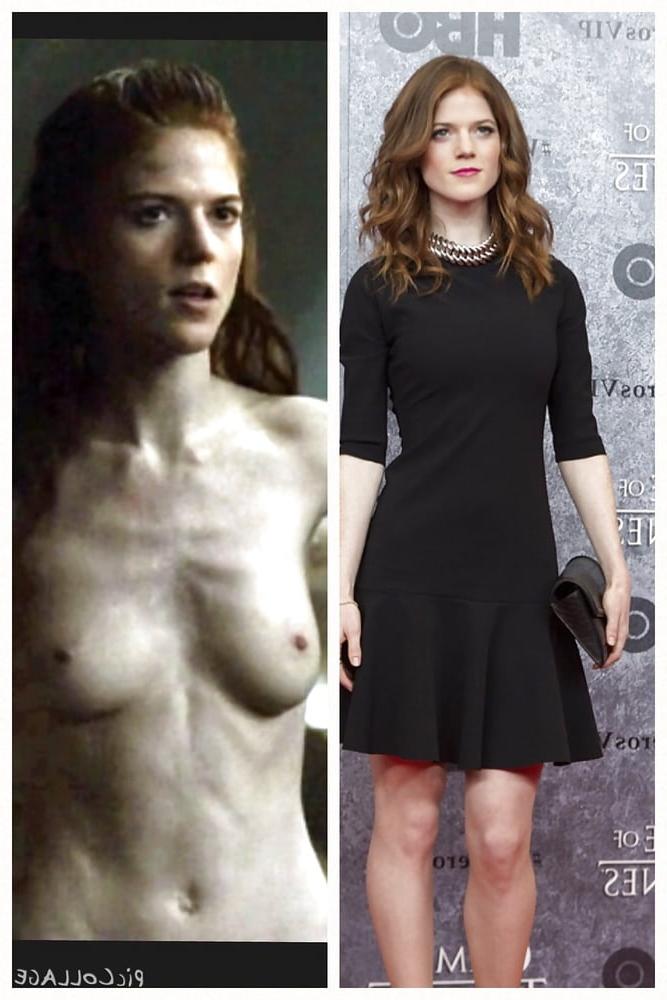 15P Before and Aftet - Celebrities 2
