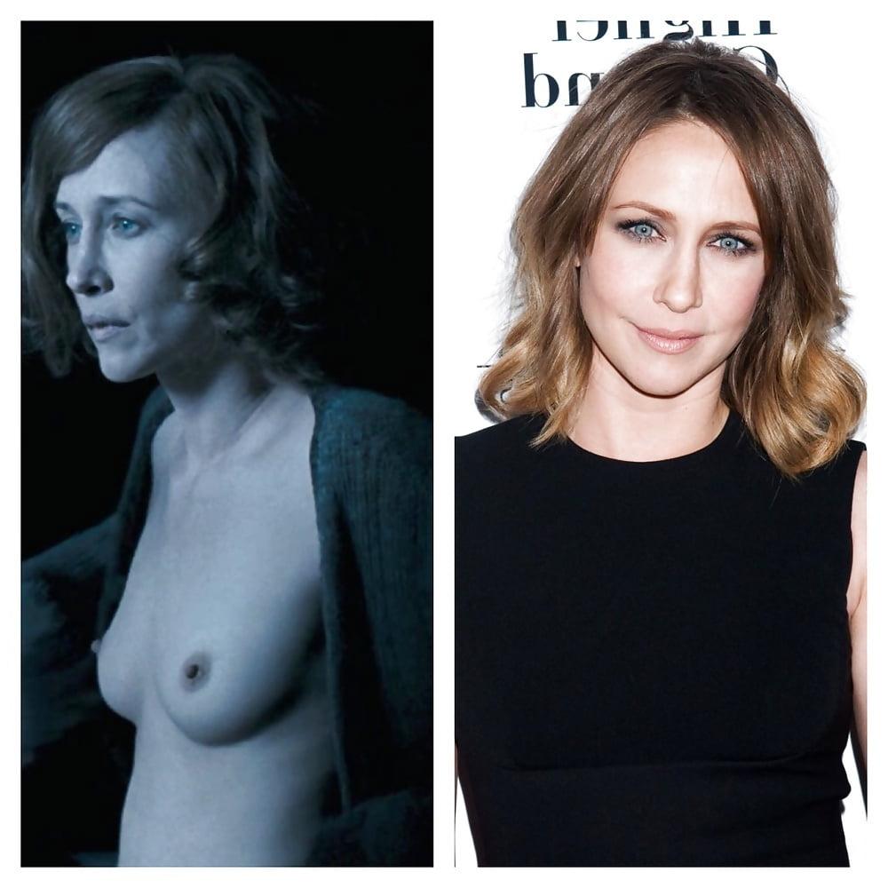 15P Before and Aftet - Celebrities 2